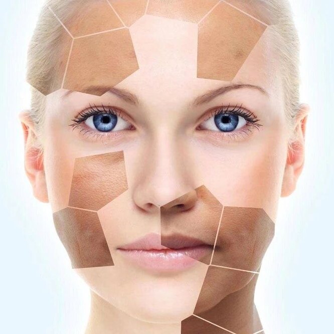 Как отбелить кожу лица